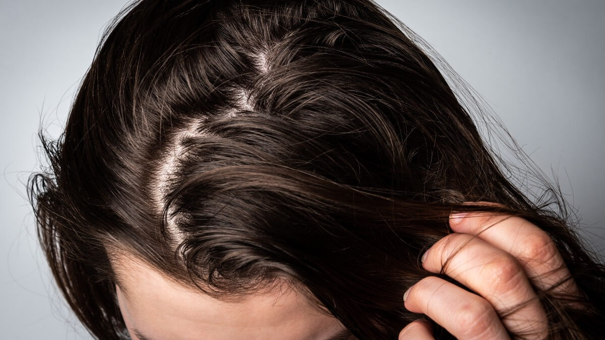 7 Reasons Why Hair Gets Greasy So Fast, and What Can You Do About It /  Bright Side